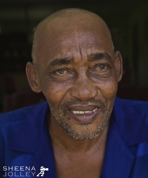 Ruben is partially sighted and has a leg amputated as a result of diabetes